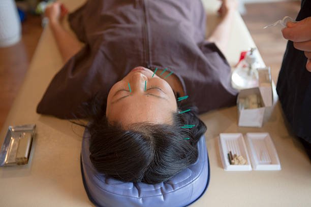 japanese female get acupuncture treatment on her face in kyoto japan