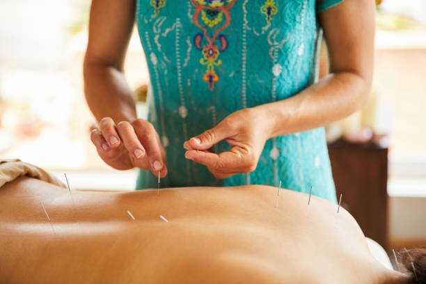 advanced acupuncture techniques for mind body balance2